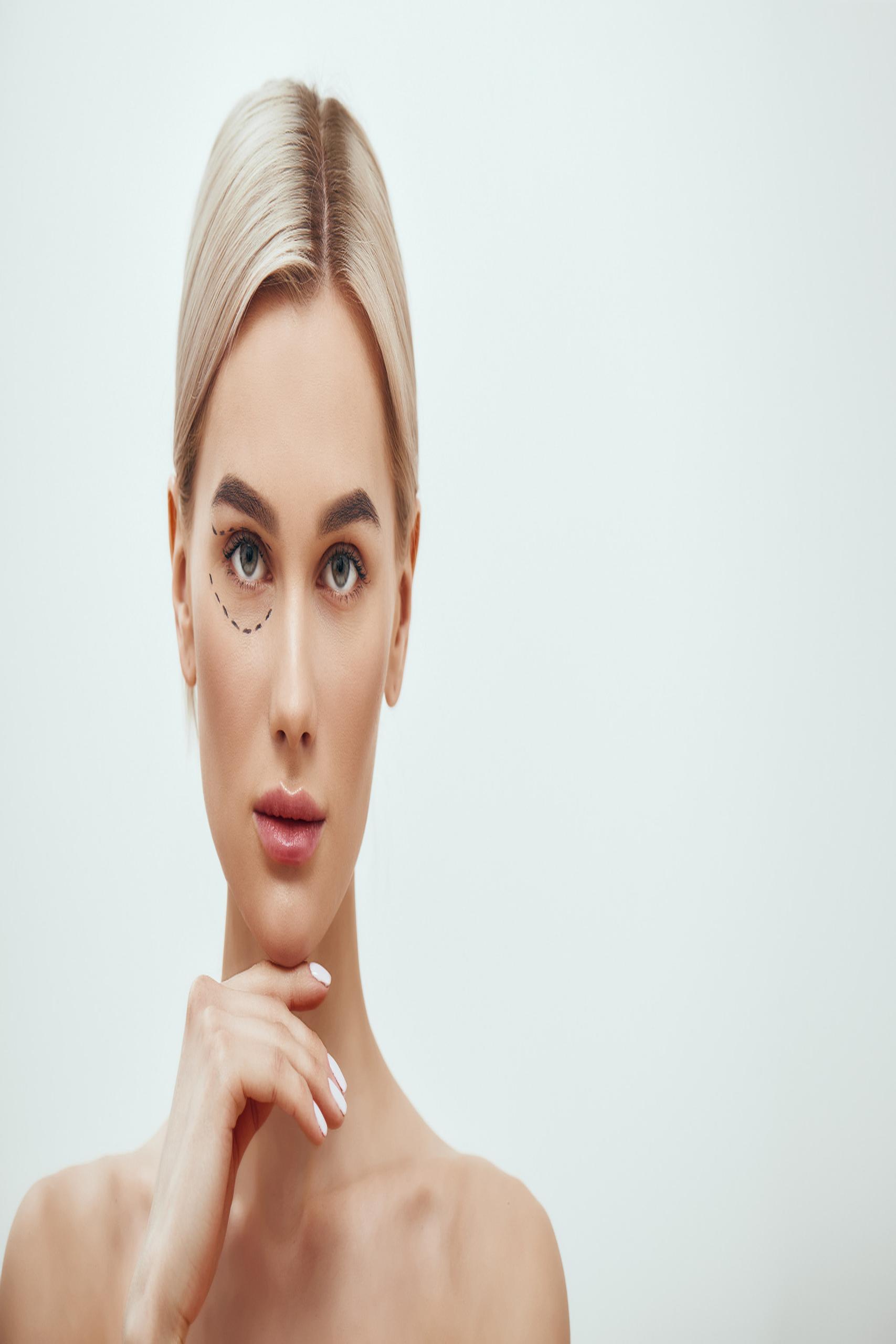 resized_Blepharoplasty MAIN