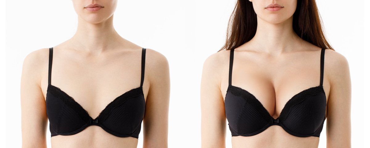 resized_breast implants sub1