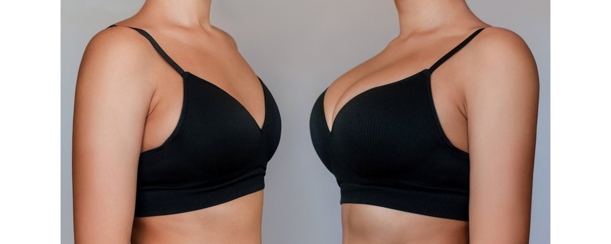 resized_breast implants sub3